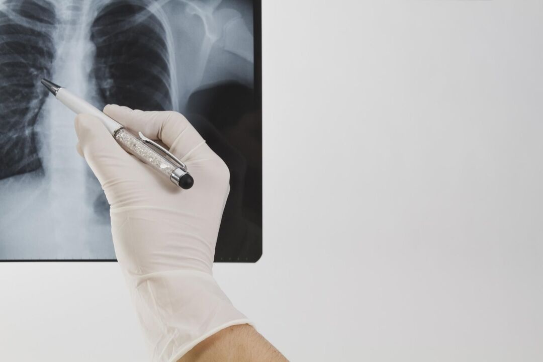 X-ray pikeun diagnosis osteochondrosis