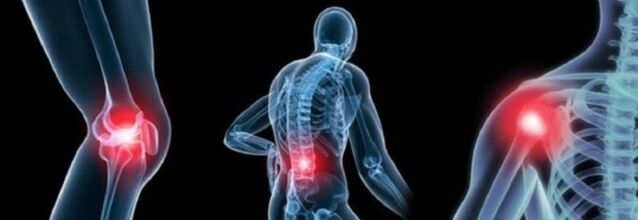 Jenis nyeri kalayan arthrosis