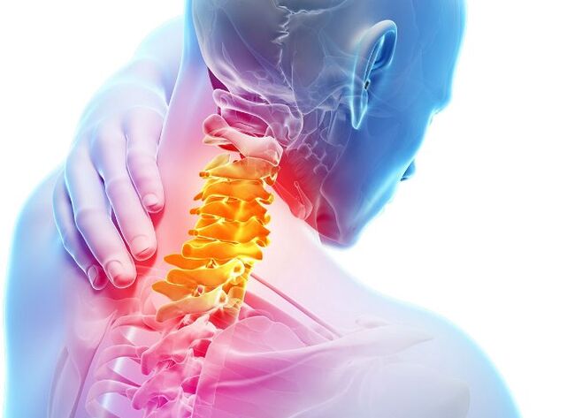 Gejala sareng tahap pamekaran osteochondrosis cervical