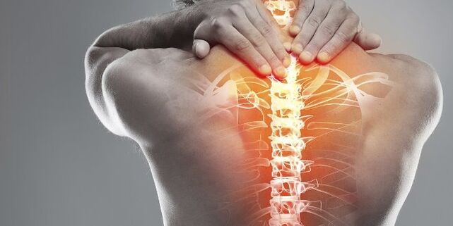 Pilihan médis pikeun terapi cervical osteochondrosis cervical