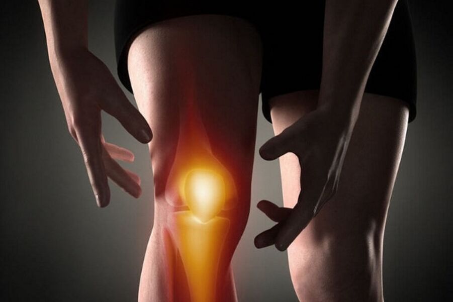 Kalayan arthrosis, nyeri janten langkung kuat nalika gerakan