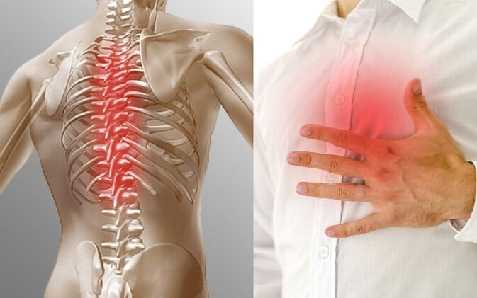 Osteochondrosis thoracic diwujudkeun ku nyeri sareng rasa sesak dina dada