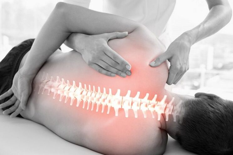 sesi terapi manual pikeun osteochondrosis tina tulang tonggong thoracic